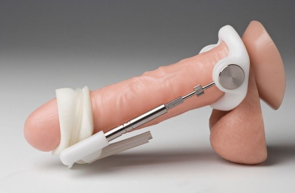 Expander increases penis thickness